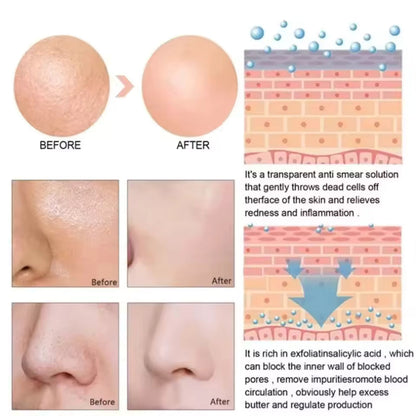 Lactic Acid Pore Refining Serum